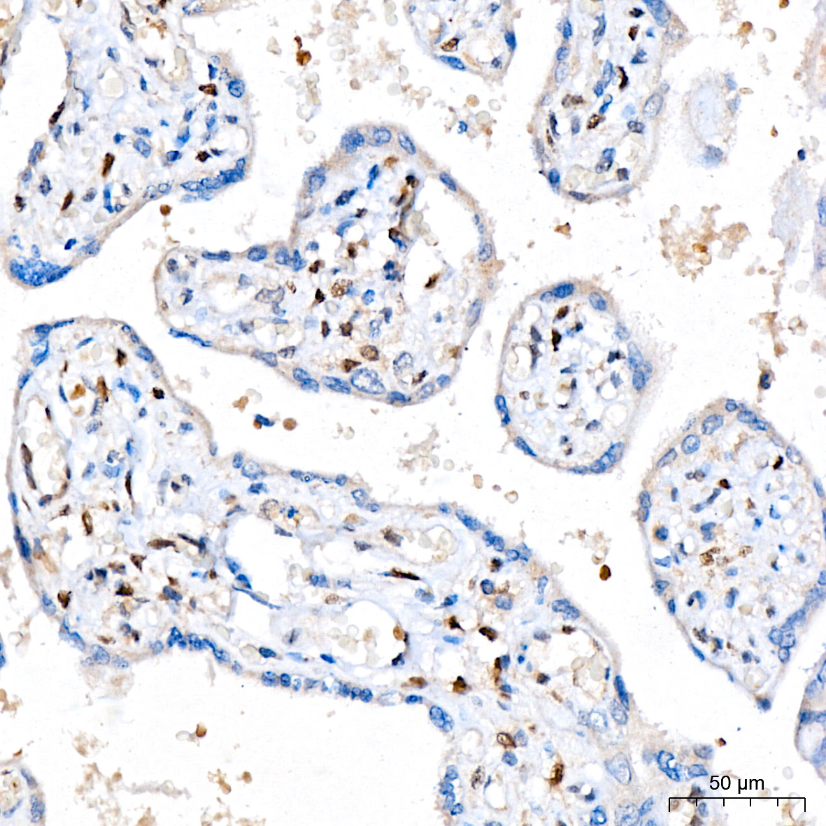 FGF2 Rabbit mAb