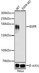 Western blot - [KD Validated] EGFR Rabbit pAb (A11576)