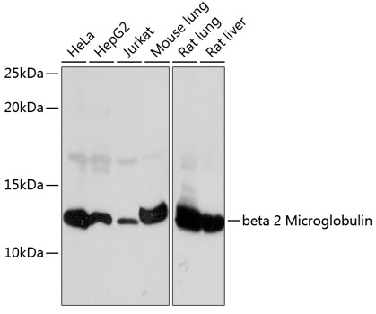 beta 2 Microglobulin Rabbit mAb
