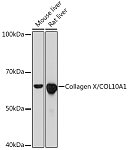Western blot - Collagen X/COL10A1 Rabbit mAb (A11645)