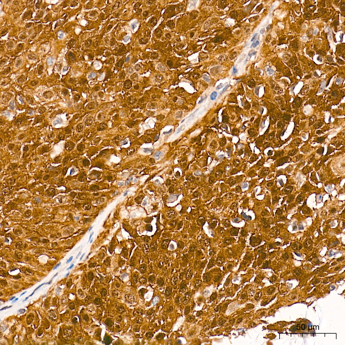 [KO Validated] CDKN2A/p16INK4a Rabbit mAb