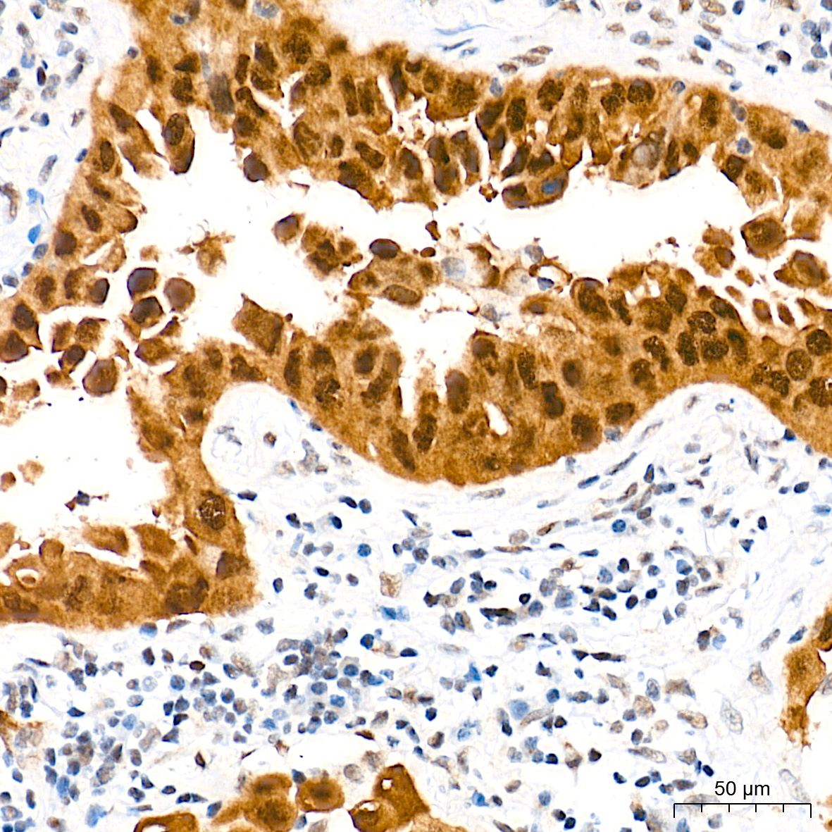 [KO Validated] CDKN2A/p16INK4a Rabbit mAb