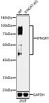 Western blot - [KO Validated] IFNGR1 Rabbit mAb (A11653)