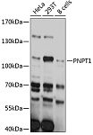 Western blot - PNPT1 Rabbit pAb (A11676)