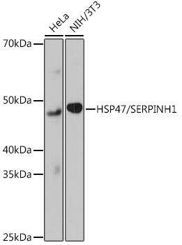 HSP47/SERPINH1 Rabbit mAb