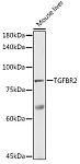 Western blot - TGF beta Receptor II (TGFBR2) Rabbit pAb (A11765)
