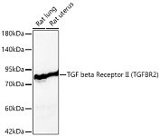 Western blot - TGF beta Receptor II (TGFBR2) Rabbit pAb (A11788)