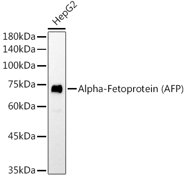 Alpha-Fetoprotein (AFP) Mouse mAb