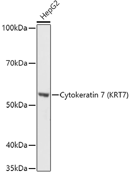 Cytokeratin 7 (KRT7) Rabbit pAb