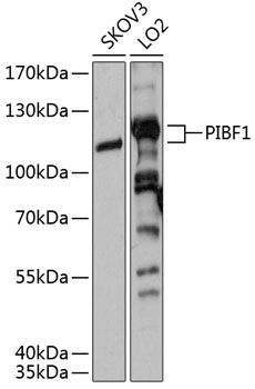 PIBF1 Rabbit pAb