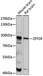 Western blot - ZFP28 Rabbit pAb (A12231)