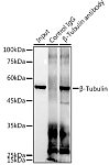 Western blot - β-Tubulin Rabbit mAb (A12289)