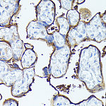 Western blot - CD138/Syndecan-1 Rabbit pAb (A1235)