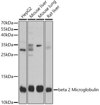 beta 2 Microglobulin Rabbit pAb