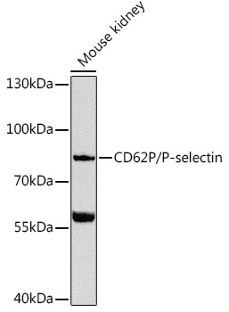 CD62P/P-selectin Rabbit pAb