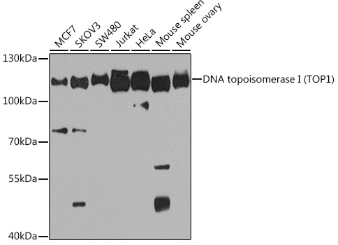 DNA topoisomerase I (TOP1) Rabbit pAb