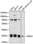 Western blot - PRPS2 Rabbit pAb (A12645)