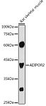 Western blot - ADIPOR2 Rabbit pAb (A12777)