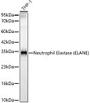 Western blot - Neutrophil Elastase (ELANE) Rabbit pAb (A13015)