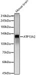 Western blot - ATP13A2 Rabbit pAb (A13083)