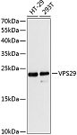 Western blot - VPS29 Rabbit pAb (A13098)