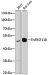 Western blot - TNFRSF11B Rabbit pAb (A13250)