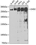 Western blot - CHD2 Rabbit pAb (A13478)