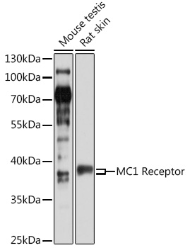 MC1 Receptor Rabbit pAb