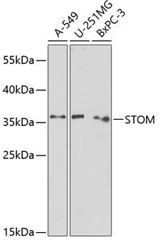 STOM Rabbit pAb