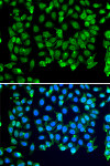 Immunofluorescence - RNF8 Rabbit pAb (A14083)