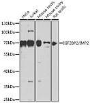 Western blot - IGF2BP2/IMP2 Rabbit pAb (A14103)