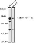 Western blot - Serotonin transporter Rabbit pAb (A14782)