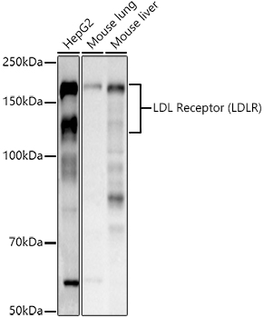 LDL Receptor (LDLR) Rabbit pAb