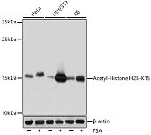 Western blot - Acetyl-Histone H2B-K15 Rabbit pAb (A15622)