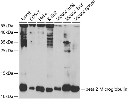 beta 2 Microglobulin Rabbit pAb