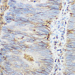 Western blot - beta 2 Microglobulin Rabbit pAb (A1562)