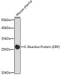 Western blot - C-Reactive Protein (CRP) Rabbit pAb (A15659)