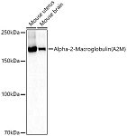 Western blot - Alpha-2-Macroglobulin (A2M) Rabbit pAb (A1573)