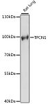 Western blot - TPCN1 Rabbit pAb (A15847)