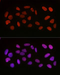 Immunofluorescence - Acetyl-HMGB1-K29 Rabbit pAb (A16002)