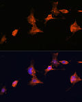 Immunofluorescence - TSC2 Rabbit pAb (A16007)