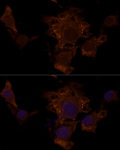 Immunofluorescence - TSC2 Rabbit pAb (A16007)