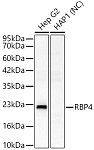 Western blot - RBP4 Rabbit pAb (A1600)