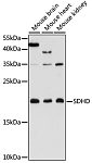 Western blot - SDHD Rabbit pAb (A16240)