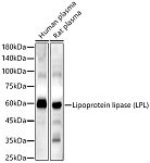 Western blot - Lipoprotein lipase (LPL) Rabbit pAb (A16252)