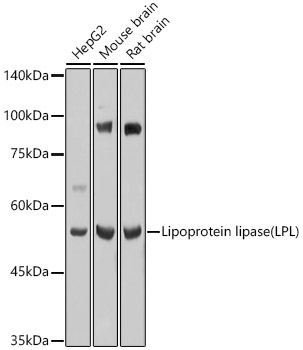 Lipoprotein lipase (LPL) Rabbit pAb