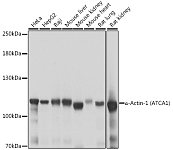 Western blot - α-Actinin-4 Rabbit pAb (A16310)