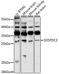 Western blot - SOSTDC1 Rabbit pAb (A16315)