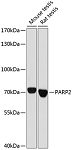 Western blot - PARP2 Rabbit pAb (A16475)