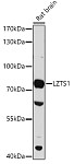 Western blot - LZTS1 Rabbit pAb (A16496)